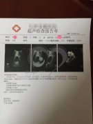41岁Z女士卵巢功能衰退不孕，试管婴儿助力重组家庭收获圆满