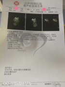 41岁Q女士结婚多年不曾生育，自卵+三代试管疗程助力好孕！