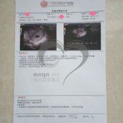 因宫颈癌导致子宫切除而不孕，39岁Y女士供卵+代孕终得偿所愿！